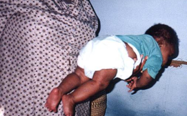 0066-03 Thula Sana Long term impact of enhanced the mother-infant relationship